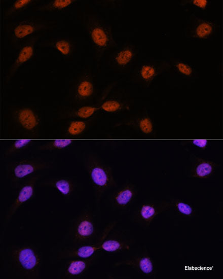 Western blot analysis of extracts of various cell lines using YAP1 Polyclonal Antibody at dilution of 1:1000.
