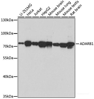 Immunofluorescence analysis of U2OS cells using DDX17 Polyclonal Antibody at dilution of 1:100. Blue: DAPI for nuclear staining.