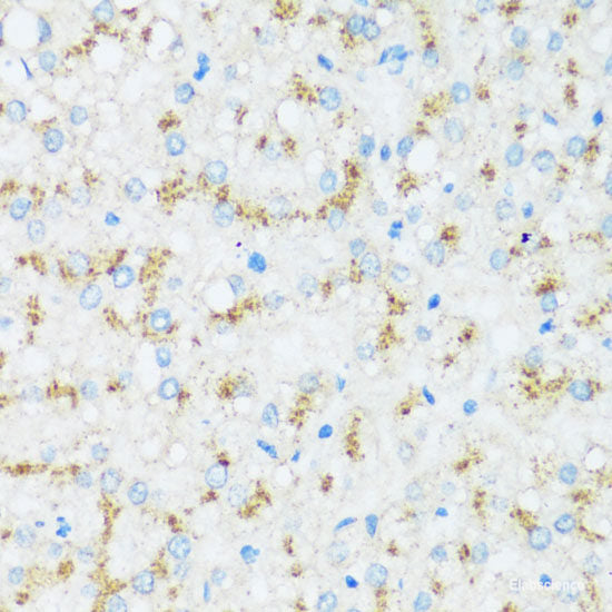 Immunohistochemistry of paraffin-embedded Human stomach using CAPN9 Polyclonal Antibody at dilution of 1:100 (40x lens).