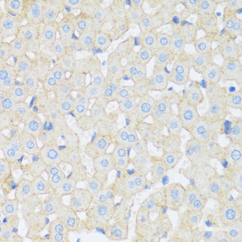 Western blot analysis of extracts of Human heart using MMP12 Polyclonal Antibody.