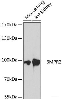 Immunohistochemistry of paraffin-embedded Rat liver using TARDBP Polyclonal Antibody at dilution of 1:200 (40x lens).