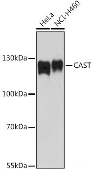 Immunofluorescence analysis of L929 cells using GAPVD1 Polyclonal Antibody at dilution of 1:100. Blue: DAPI for nuclear staining.