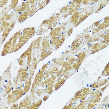 Immunohistochemistry of paraffin-embedded Mouse lung using ERCC3 Polyclonal Antibody at dilution of 1:200 (40x lens).