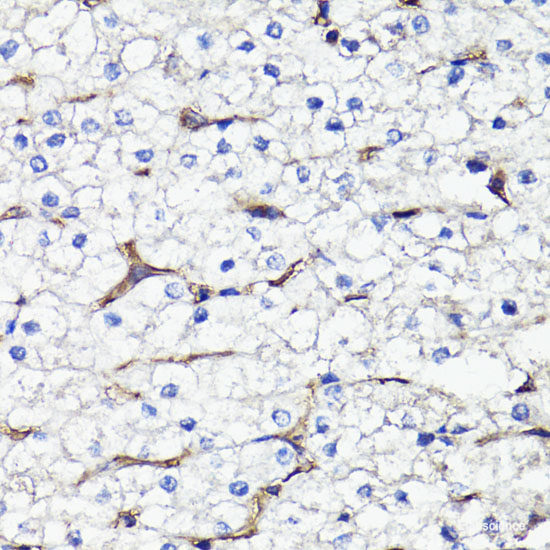 Western blot analysis of extracts of OVCAR3 cells using HSD17B12 Polyclonal Antibody at dilution of 1:1000.