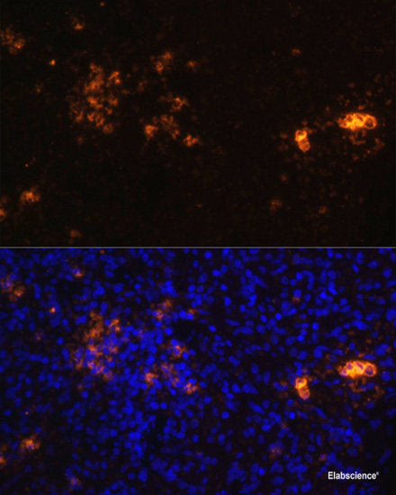 Immunohistochemistry of paraffin-embedded Human lung using ARL6IP4 Polyclonal Antibody at dilution of 1:100 (40x lens).