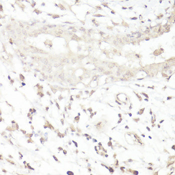 Immunohistochemistry of paraffin-embedded Human liver using ASB4 Polyclonal Antibody at dilution of 1:100 (40x lens).