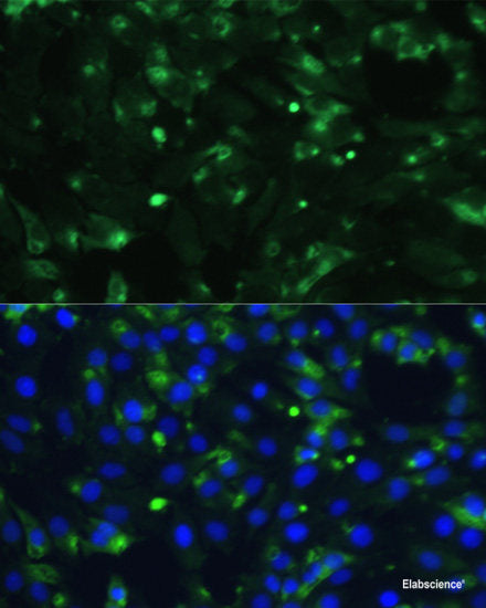 Western blot analysis of extracts of various cell lines using C1 Inactivator Polyclonal Antibody at dilution of 1:1000.