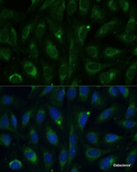 Western blot analysis of extracts of HeLa cells using CHD7 Polyclonal Antibody at dilution of 1:1000.