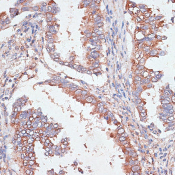 Immunofluorescence analysis of HeLa cells using DRD5 Polyclonal Antibody