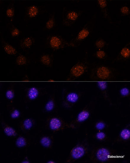 Immunohistochemistry of paraffin-embedded Rat testis using C12orf10 Polyclonal Antibody at dilution of 1:100 (40x lens).