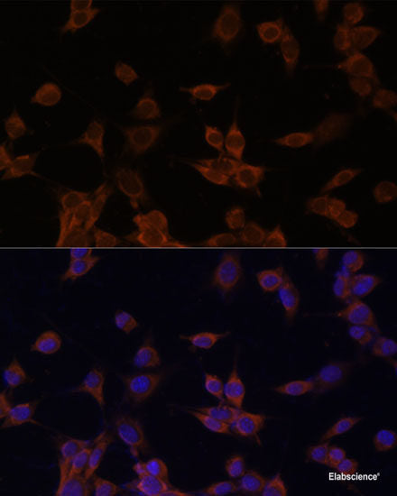 Western blot analysis of extracts of HeLa cells using TLR5 Polyclonal Antibody.