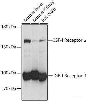 Western blot analysis of extracts of Mouse lung using COL18A1 Polyclonal Antibody at dilution of 1:1000.