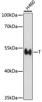 Immunohistochemistry of paraffin-embedded Rat liver using BRSK1 Polyclonal Antibody at dilution of 1:100 (40x lens).