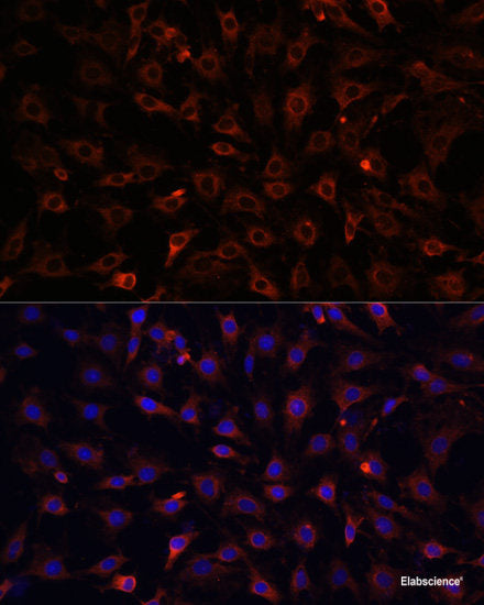 Immunohistochemistry of paraffin-embedded Rat spleen using YKL-40 / CHI3L1 Polyclonal Antibody at dilution of 1:100 (40x lens).