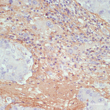 Immunofluorescence analysis of L929 cells using ZCCHC3 Polyclonal Antibody at dilution of 1:100. Blue: DAPI for nuclear staining.