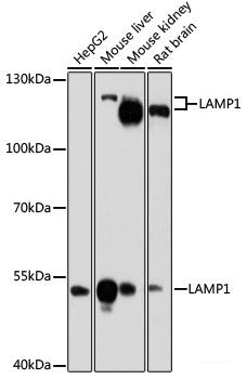 Western blot analysis of extracts of Jurkat cells using MED1 Polyclonal Antibody.