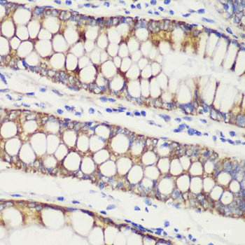 Immunohistochemistry of paraffin-embedded Rat brain using AVP Polyclonal Antibody at dilution of 1:100 (40x lens).
