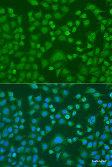 Immunohistochemistry of paraffin-embedded Rat liver using LRRK2 Polyclonal Antibody at dilution of 1:200 (40x lens).
