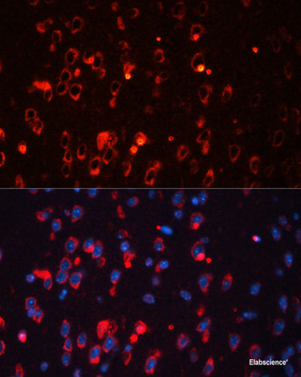 Western blot analysis of extracts of various cell lines using PLGF Polyclonal Antibody at dilution of 1:1000.