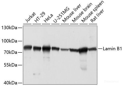 Immunofluorescence analysis of Mouse testis using Kctd19 Polyclonal Antibody at dilution of 1:100. Blue: DAPI for nuclear staining.