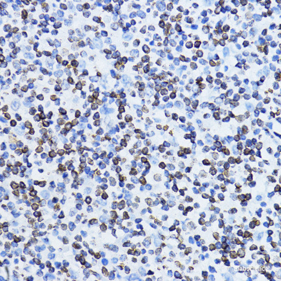 Immunohistochemistry of paraffin-embedded Human colon using BLOC1S3 Polyclonal Antibody at dilution of 1:100 (40x lens).