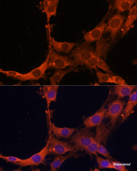 Western blot analysis of extracts of Mouse kidney using MEX3D Polyclonal Antibody at dilution of 1:1000.