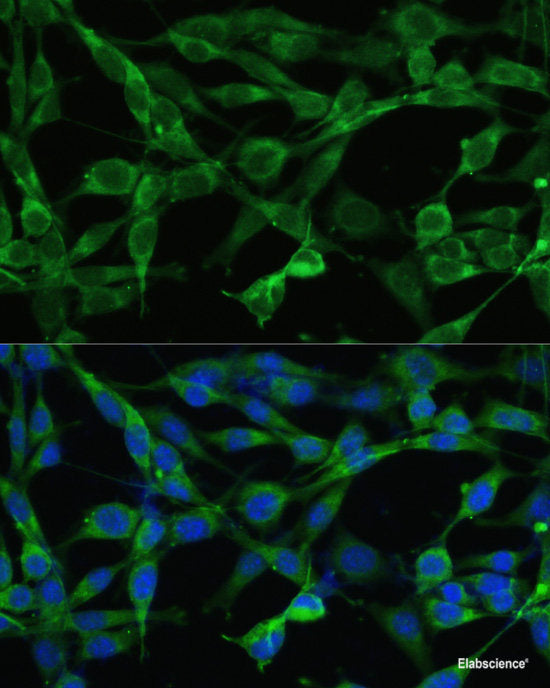 Immunohistochemistry of paraffin-embedded Rat testis using C10orf62 Polyclonal Antibody at dilution of 1:100 (40x lens).