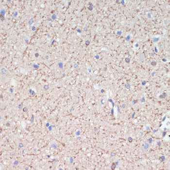 Immunofluorescence analysis of HeLa cells using PRKAA1/PRKAA2 Polyclonal Antibody at dilution of 1:100. Blue: DAPI for nuclear staining.