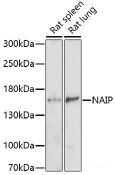 Immunohistochemistry of paraffin-embedded Rat testis using MAPK1/MAPK3 Polyclonal Antibody at dilution of 1:200 (40x lens).