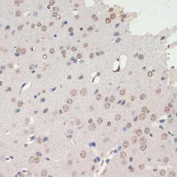 Immunohistochemistry of paraffin-embedded Rat bronchus using DEPDC6 Polyclonal Antibody at dilution of 1:200 (40x lens).