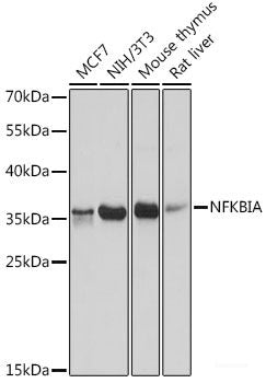Immunofluorescence analysis of C6 cells using SIRT1 Polyclonal Antibody at dilution of 1:100. Blue: DAPI for nuclear staining.