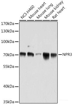 Immunohistochemistry of paraffin-embedded Human colon carcinoma using MLKL Polyclonal Antibody at dilution of 1:200 (40x lens).