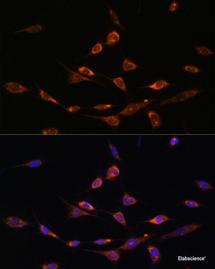 Immunofluorescence analysis of NIH-3T3 cells using PIK3R3 Polyclonal Antibody at dilution of 1:100. Blue: DAPI for nuclear staining.