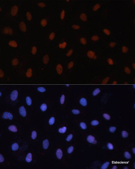 Western blot analysis of extracts of Rat heart using NUAK1 Polyclonal Antibody at dilution of 1:1000.