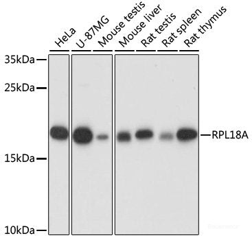 Western blot analysis of extracts of Rat testis using INHA Polyclonal Antibody at dilution of 1:1000.