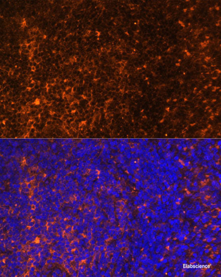 Immunohistochemistry of paraffin-embedded Rat brain using Map2 Polyclonal Antibody at dilution of 1:100 (40x lens).