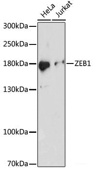 Immunofluorescence analysis of U-2OS cells using LIG4 Polyclonal Antibody at dilution of 1:100. Blue: DAPI for nuclear staining.