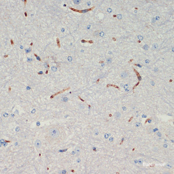 Western blot analysis of extracts of ZR-75-1 cells using MDM4 Polyclonal Antibody.