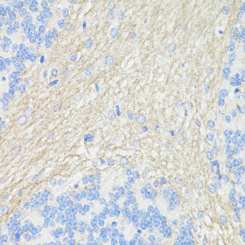 Immunohistochemistry of paraffin-embedded Human tonsil using CD3E Polyclonal Antibody at dilution of 1:200 (40x lens).