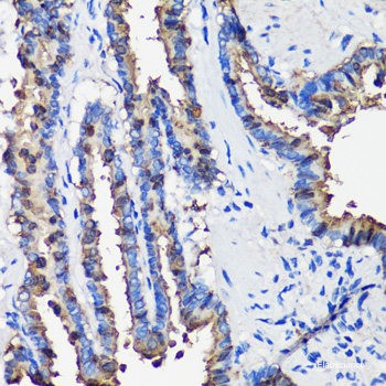 Western blot analysis of extracts of various cell lines using CNR2 Polyclonal Antibody at dilution of 1:3000.