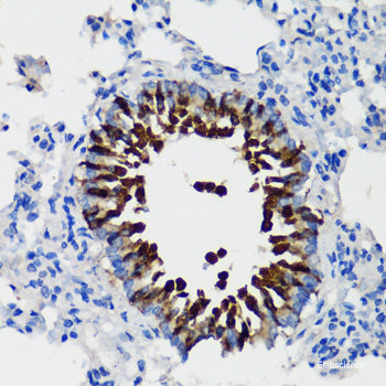 Immunohistochemistry of paraffin-embedded Human tonsil using FKBP1A Polyclonal Antibody at dilution of 1:200 (40x lens).