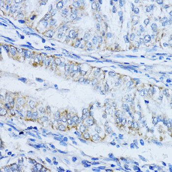 Immunofluorescence analysis of A549 cells using AIRE Polyclonal Antibody