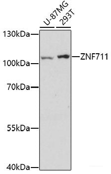 Immunohistochemistry of paraffin-embedded Human amygdalitis using FTL Polyclonal Antibody at dilution of 1:100 (40x lens).