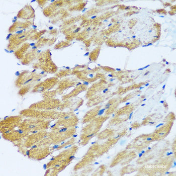 Immunofluorescence analysis of MCF-7 cells using PSMB9 Polyclonal Antibody