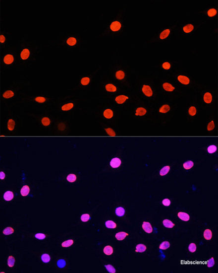 Immunohistochemistry of paraffin-embedded Human stomach using Cyclin D2 Polyclonal Antibody at dilution of 1:100 (40x lens).