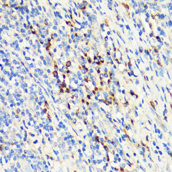 Immunofluorescence analysis of U-2 OS cells using IGF2BP2 Polyclonal Antibody at dilution of 1:100. Blue: DAPI for nuclear staining.