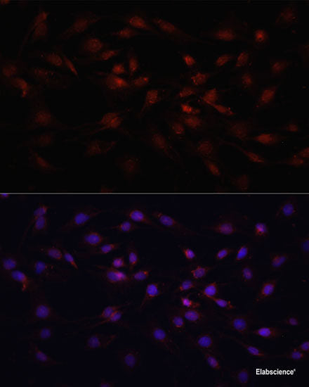 Immunohistochemistry of paraffin-embedded Rat kidney using GGT1 Polyclonal Antibody at dilution of 1:100 (40x lens).