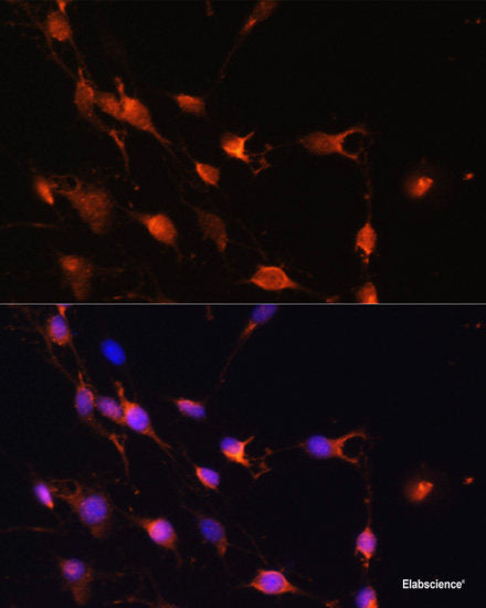 Immunohistochemistry of paraffin-embedded Human colon using CD82 Polyclonal Antibody at dilution of 1:100 (40x lens).