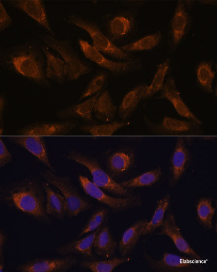 Western blot analysis of extracts of 293T cells using KIR2DS4 Polyclonal Antibody at dilution of 1:1000.