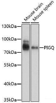 Western blot analysis of extracts of various cell lines using POLR2C Polyclonal Antibody at dilution of 1:1000.